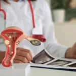 How Endometriosis Is Diagnosed and Managed Effectively