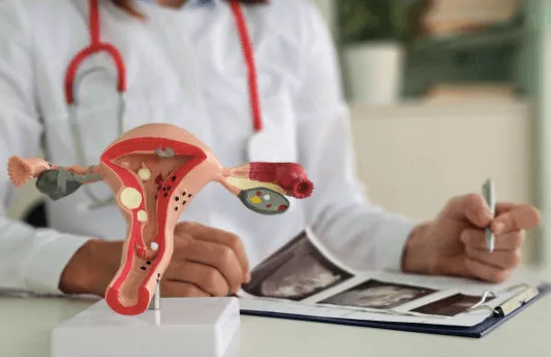 How Endometriosis Is Diagnosed and Managed Effectively