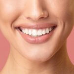 Benefits of Porcelain Veneers for a Bright Smile