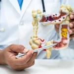 Colorectal Cancer Screening