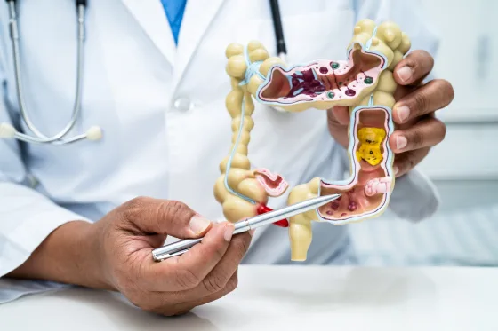 Colorectal Cancer Screening