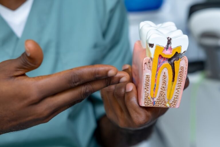 Root Canals