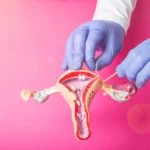Tubal Reversal and IVF