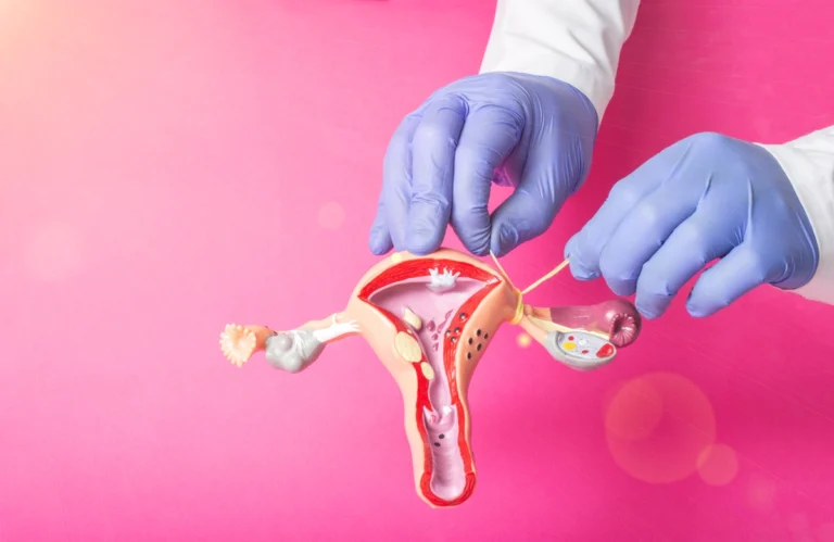 Tubal Reversal and IVF